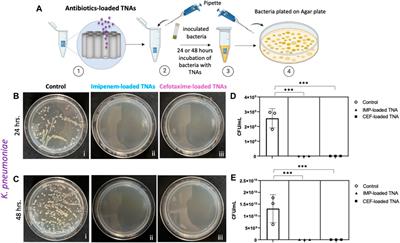 Synergistic antibacterial activity and inhibition of TiO2 nanotube arrays and loaded antibiotics against gram-positive and gram-negative bacteria